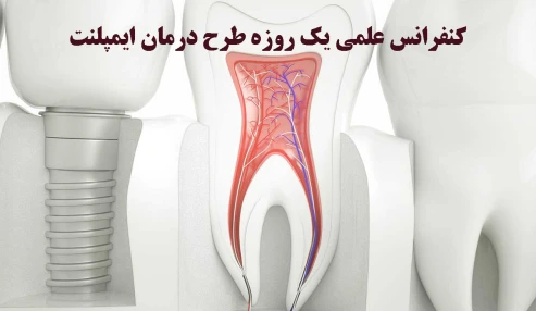 کنفرانس علمی یک روزه طرح درمان ایمپلنت