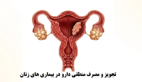 تجویز و مصرف منطقی دارو در بیماری های زنان