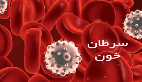 وبینار علمی  مدیریت خون بیمار در بیماران سرطانی