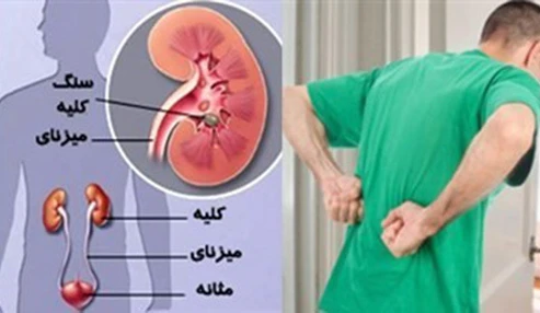 وبینار علمی  دارو درماني اختلالات کلیوی