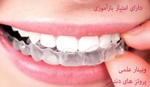 پروتزهای دندانی