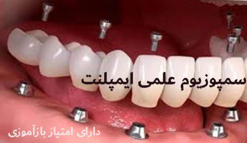 سمپوزیوم ایمپلنت