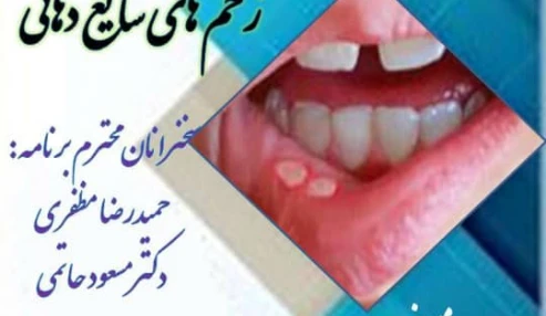 وبینار علمی  زخم های شایع دهانی