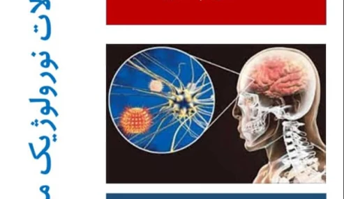 اختلالات نورولوژیک مرتبط با کرونا