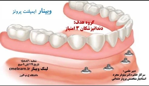 وبینار علمی  پروتز ایمپلنت