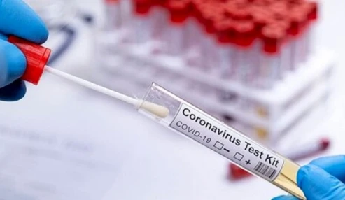وبینار علمی covid-19 وتشخیص مولکولی آن