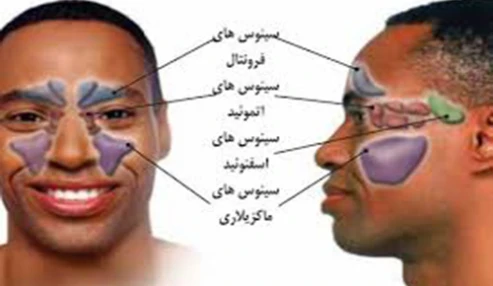وبینار علمی کنفرانس علمی یک روزه بیماری های شایع بینی و سینوس