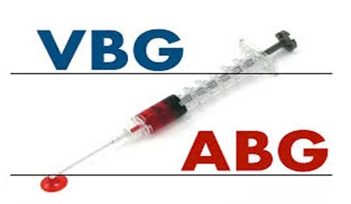 وبینار علمی تفسیر ABG