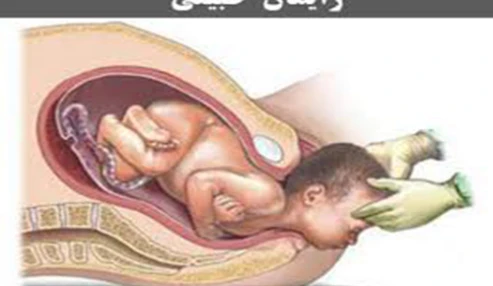 وبینار علمی  زایمان طبیعی