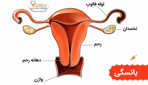 وبینار علمی یائسگی