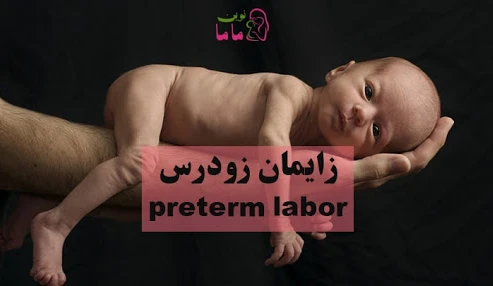 وبینار علمی  زایمان زودرس(علل،علائم،مدیریت وکنترل)