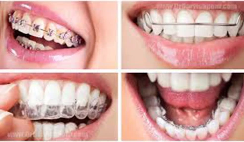 وبینار علمی   تشخیص و طبقه‌بندی در ارتودنسی