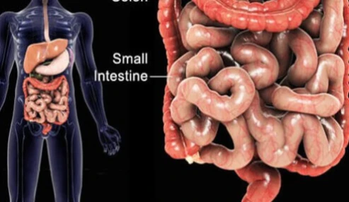 وبینار علمی  تشخیص درمان و آموزش در بیماران مبتلا به IBD