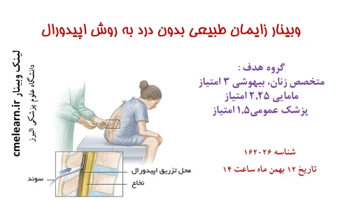 وبینار علمی  زایمان طبیعی بدون درد به روش اپیدورال