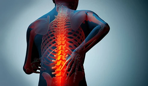 رویکرد تشخیصی و درمانی به استئوپروز