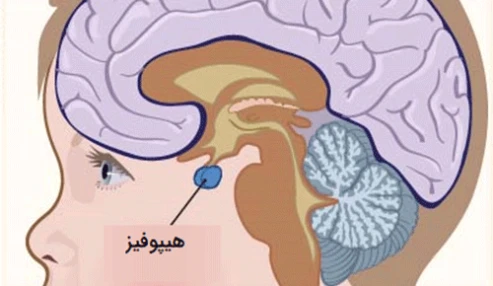 وبینار علمی  اختلالات هیپوفیز و رشد در کودکان و بزرگسالان