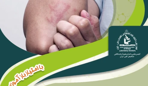 تشخیص آزمایشگاهی قارچ شناسی درماتوفیتهای شایع